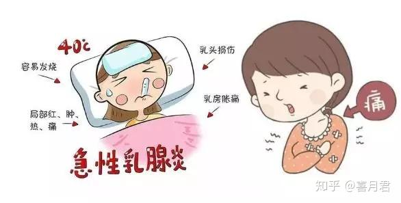 乳腺炎反復發(fā)作？這6個方法很管用